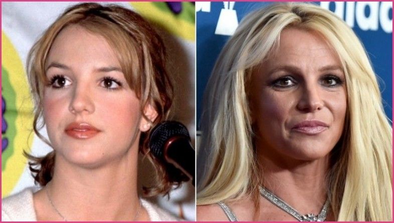 Popular Celebrity Plastic Surgery